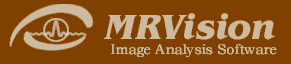 ロゴ:MRVision社