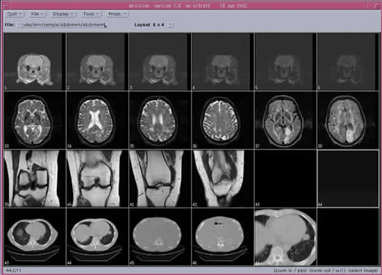 画像:異なる画像ファイルの同時表示