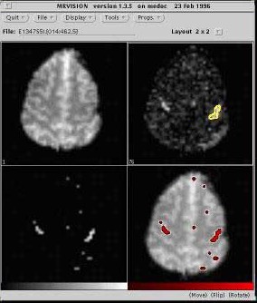 画像:統計処理の適用